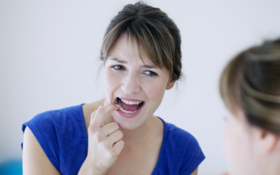¿Cuál es la mejor forma de prevenir la gingivitis?